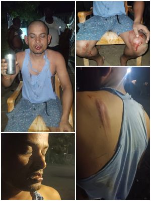 अवारा मवेशियों कों लेकर उपजा खूनी संघर्ष   किसानों की लाचारी, प्रशासन की चुप्पी और मूक प्राणियों की बलि