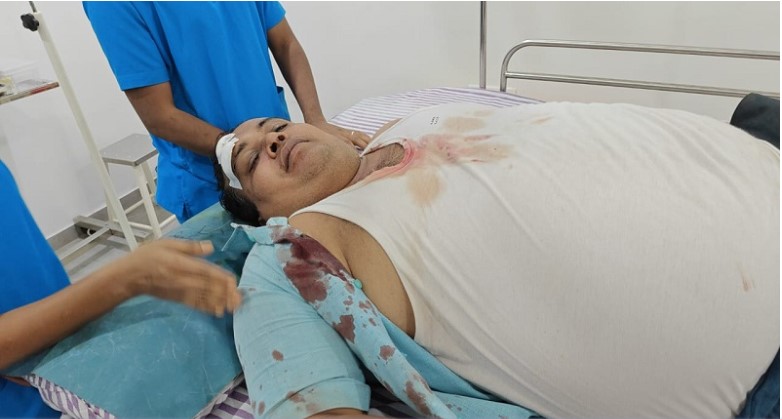  डॉक्टर के सिर पर पत्थर मार किया गंभीर रूप से घायल