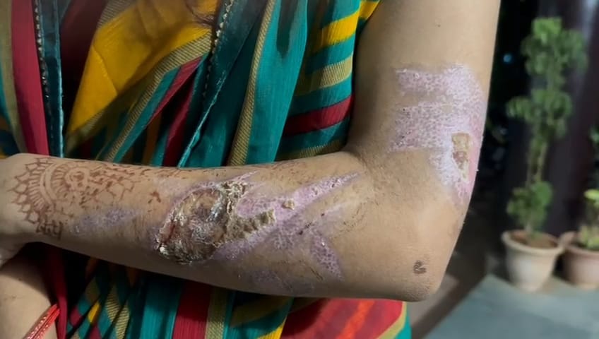 पति की हैवानियत: महिला के साथ बर्बरता