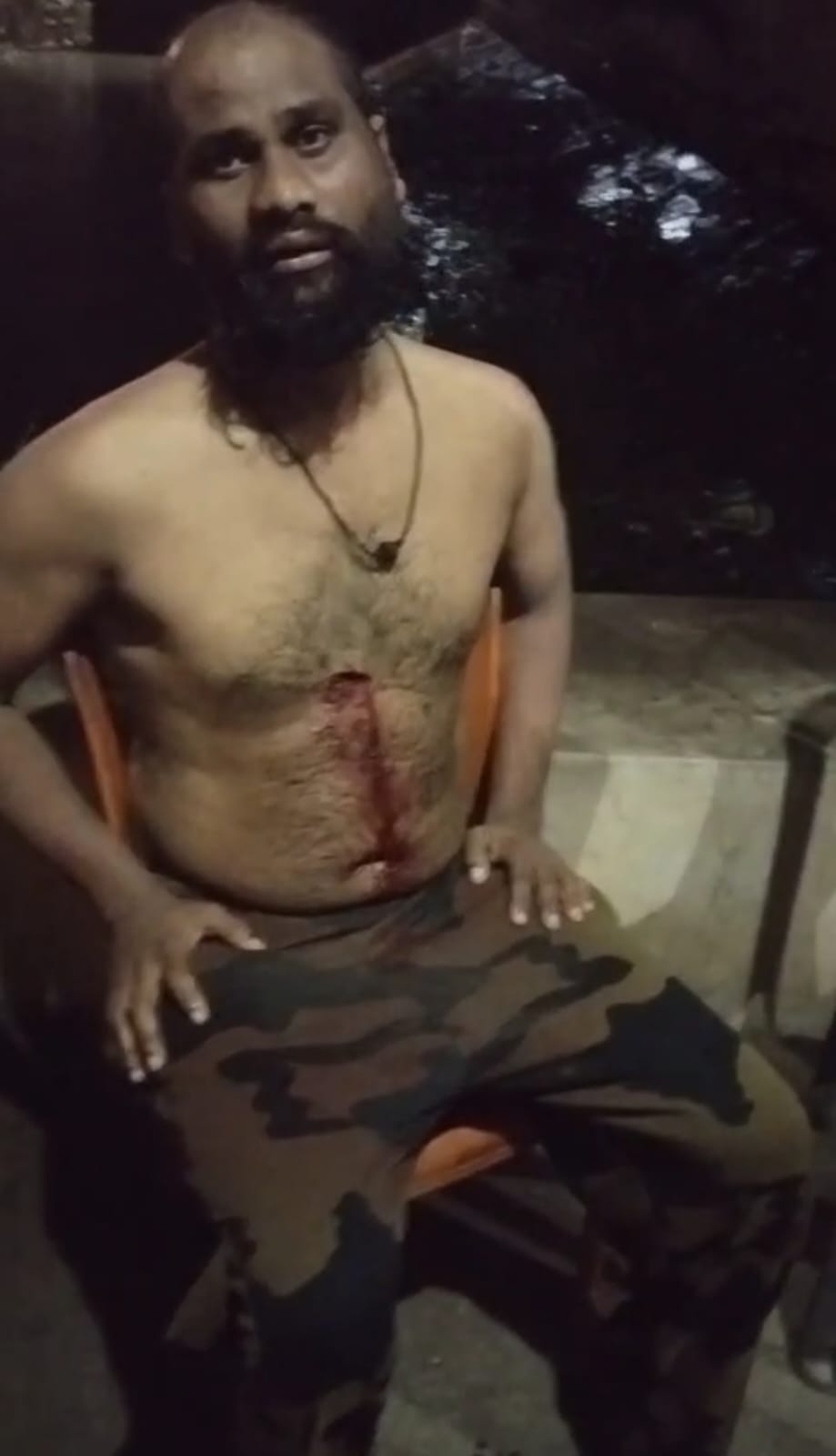 अकलतरा थाना क्षेत्र के शराब दुकान के पास अज्ञात हमलावरो ने चाकू से किया युवक पर हमला 