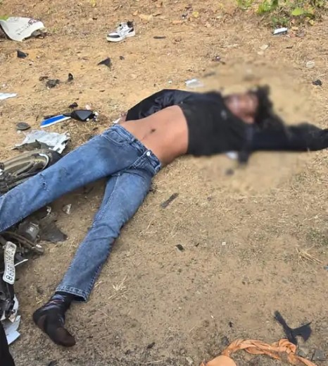 तेज रफ्तार बाइक और कार की टक्कर, एक की मौत:सोनहत-बैकुंठपुर