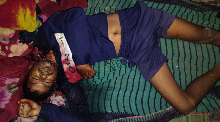 ताने मारना का अंजाम पड़ा भारी,बहनोई ने दोस्त के साथ मिलकर बड़े साले को कुल्हाड़ी से उतारा मौत के घाट   लंबे समय से चल रहे पारिवारिक विवाद ने लिया हिंसक रूप, हत्या के बाद दोनों आरोपी गिरफ्तार