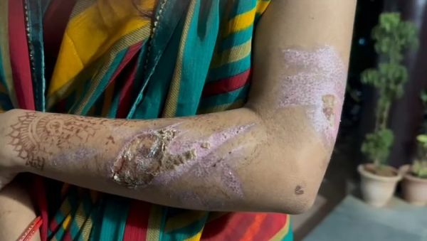 पति की हैवानियत: महिला के साथ बर्बरता