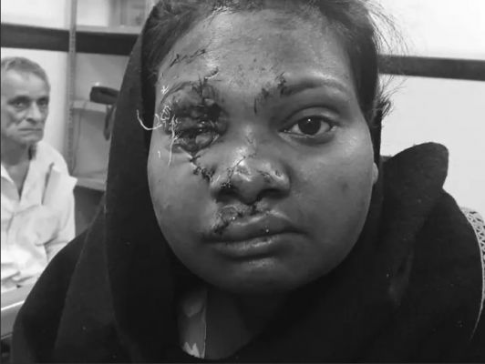 रायपुर में देर-रात मोबाइल बिजी मिलने पर गर्लफ्रेंड का मर्डर