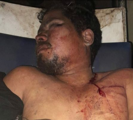 जूठी थाली से शुरू हुआ विवाद, सिलतरा में चाकूबाजी से युवक की मौत 24 घंटे में पुलिस ने सुलझाई गुत्थी, दो आरोपी गिरफ्तार