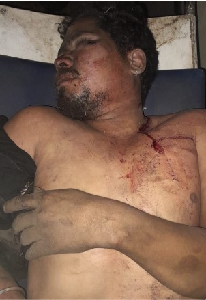 हाइवे ढाबों का नशे का जाल बना मौत की वजह  सिलतरा में मामूली विवाद पर युवक की चाकू से हत्या  अवैध बारों के संरक्षण पर उठे गंभीर सवाल