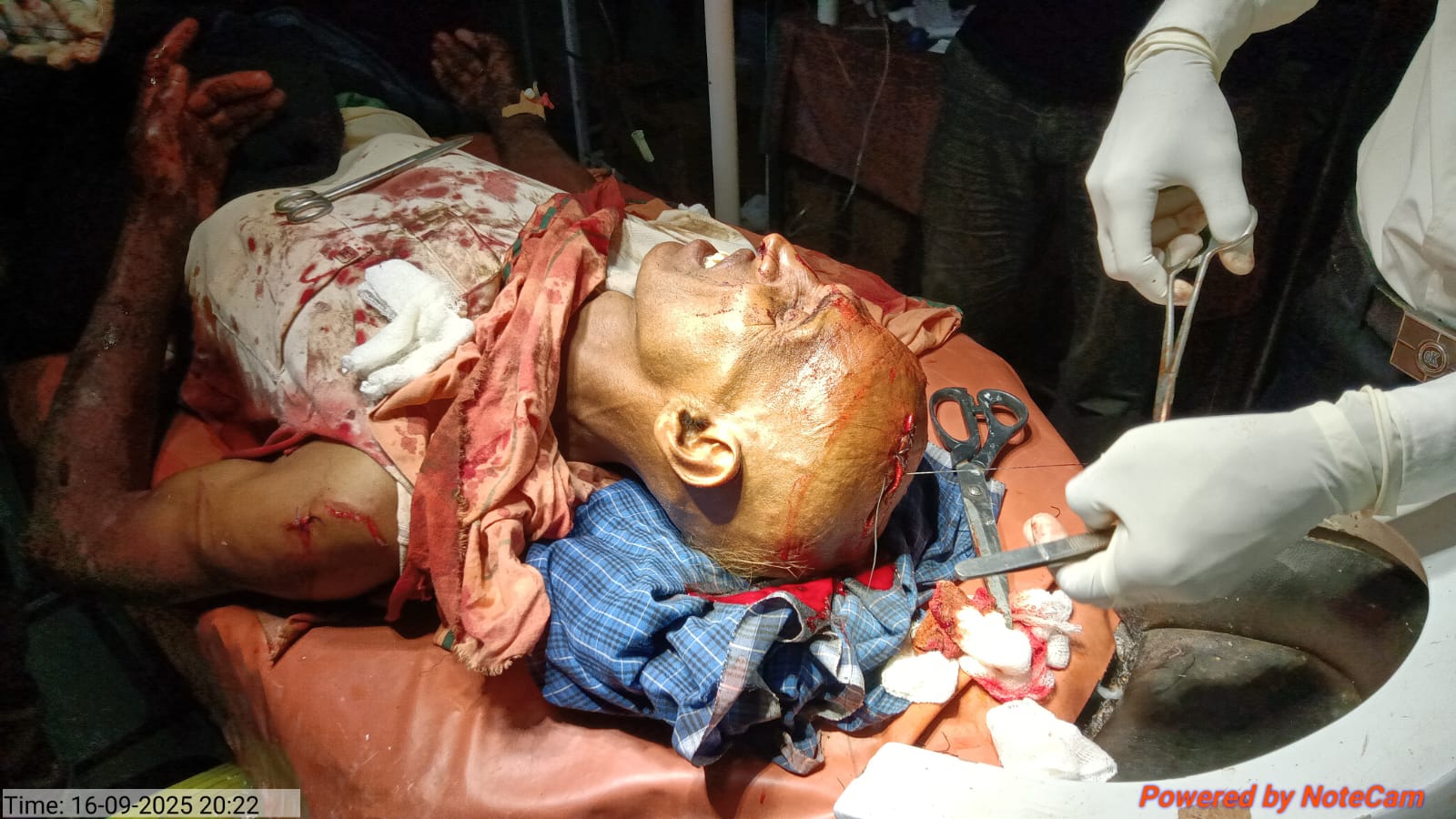 बलरामपुर में भालू के हमले से अधेड़ घायल